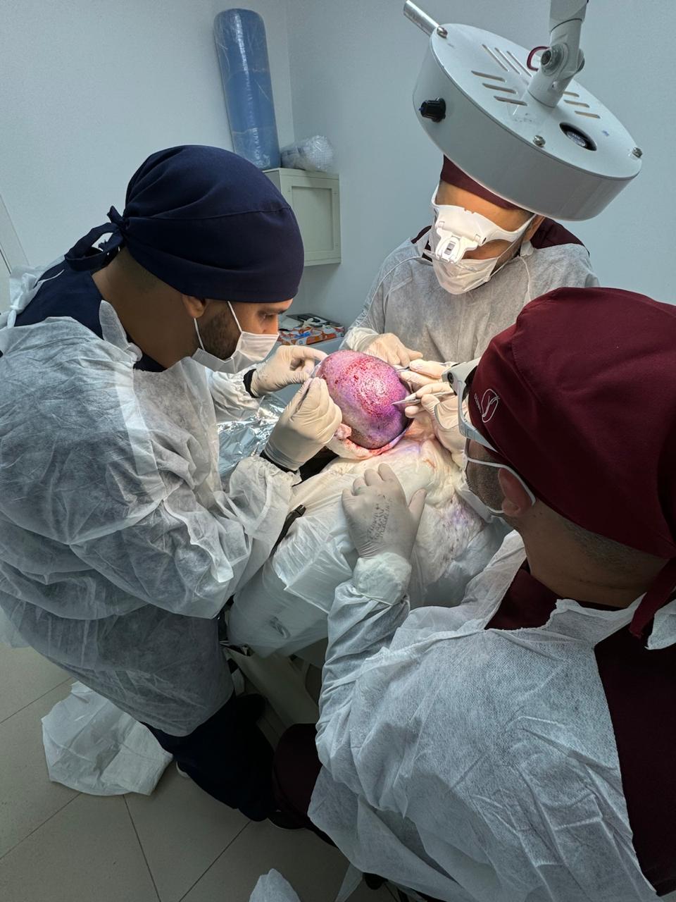 Equipe durante um procedimento capilar